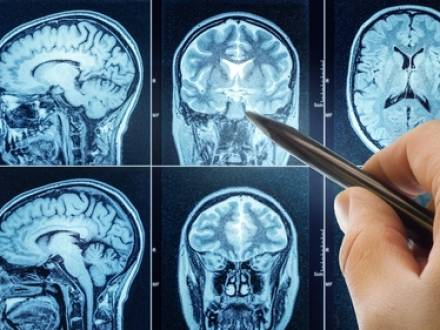 Upper Marlboro, MD personal injury lawyer